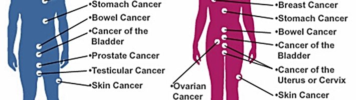 Types of Cancer 710x200 - Types of Cancer and Cancer Charities